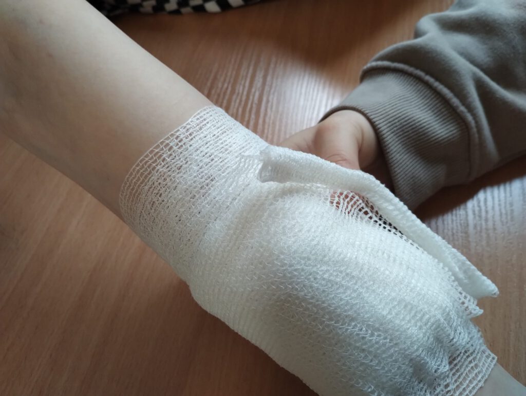 Zdjęcie przedstawia sposób zabezpieczania ramienia po urazie. 