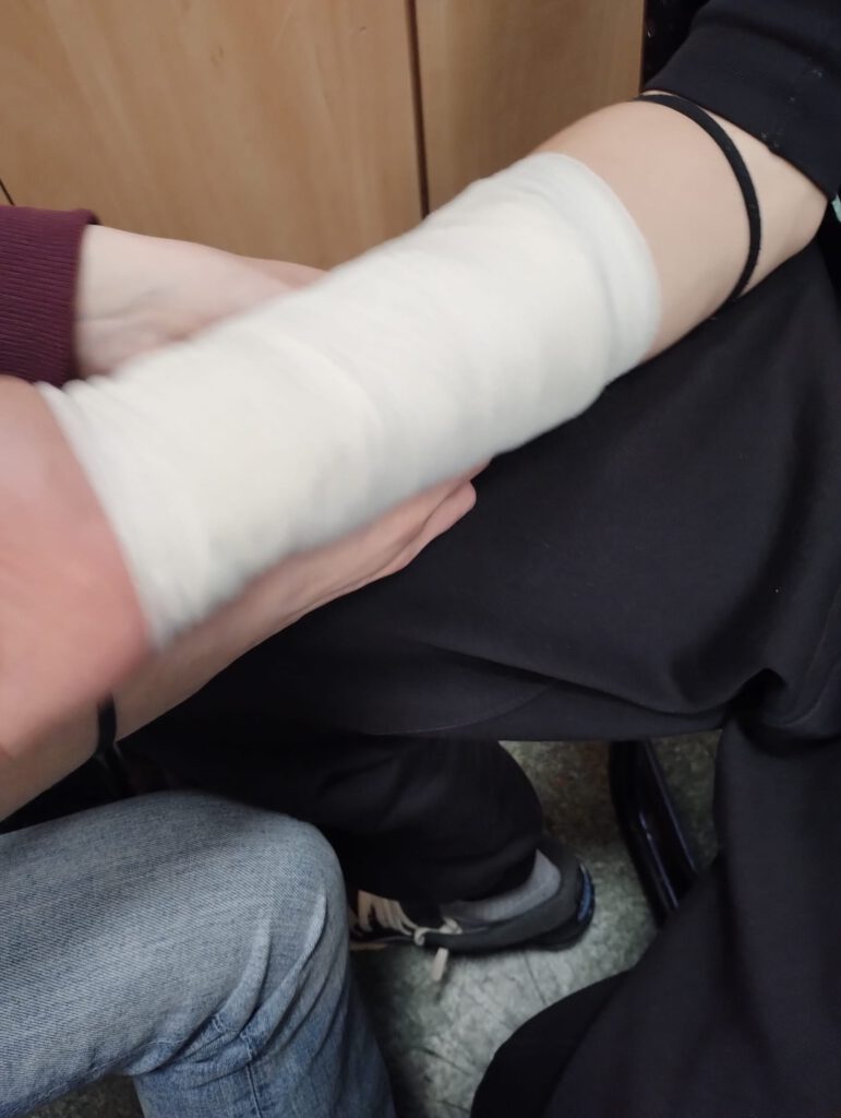 Zdjęcie przedstawia sposób zabezpieczania przedramienia po urazie. 