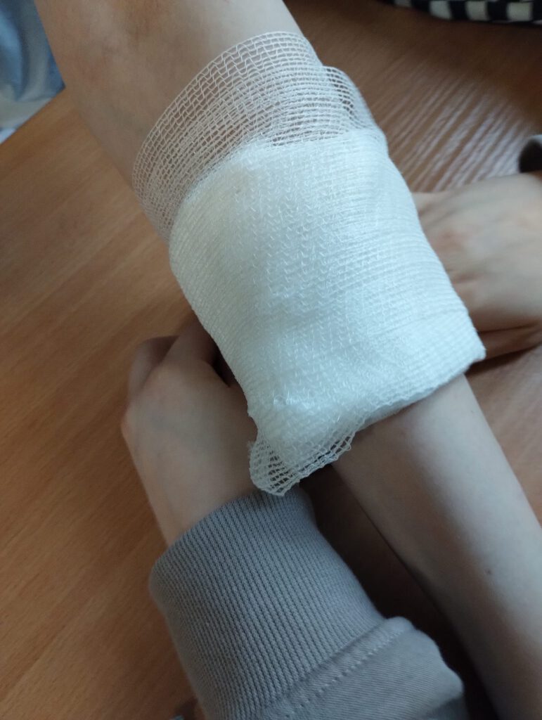 Zdjęcie przedstawia sposób zabezpieczania przedramienia po urazie. 