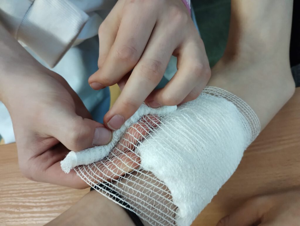 Zdjęcie przedstawia sposób zabezpieczania przedramienia po urazie. 